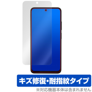 Xiaomi Redmi Note 11S / 11 保護 フィルム OverLay Magic シャオミー スマホ レドミ ノート 液晶保護 傷修復 耐指紋 指紋防止