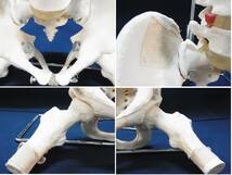 ▲骨格標本 脊髄模型 脊髄骨盤模型 スタンド付き 脊髄 骨盤 股関節 脊髄神経根 椎間板 吊り下げ式 骨 人体模型 骨格模型 実物大 医療▲160_画像10