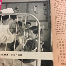 日本の結核　角川写真文庫　1955年発行　島村喜久治・北錬平　朝倉隆・川島浩_画像2