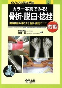 カラー写真でみる！骨折・脱臼・捻挫　改訂版 画像診断の進め方と整復・固定のコツ ビジュアル基本手技２／内田淳正(編者),加藤公(編者)