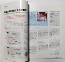 雑誌 日経メディカル3冊＝2015年12月号+2016年5月号+2016年3月号　医師の転職/院内感染対策/医師偏在_画像10