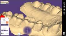 歯科　歯科技工　デジタルクラウンレングスニングガイドデータ作成手順動画　mp4 meshmixer_画像3