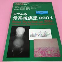 B08-096 小児内科 目でみる骨系統疾患2004 東京医学社 _画像1