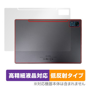 CHUWI Hi10 Xpro 背面 保護 フィルム OverLay Plus Lite ツーウェイ タブレット 本体保護フィルム さらさら手触り低反射素材