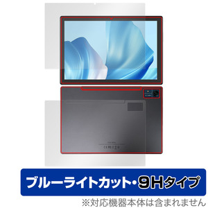 CHUWI Hi10 Xpro 表面 背面 フィルム OverLay Eye Protector 9H ツーウェイ タブレット 表面・背面セット 9H 高硬度 ブルーライトカット