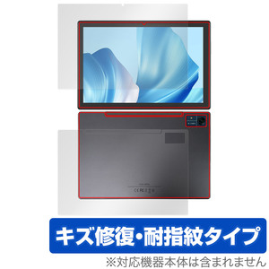 CHUWI Hi10 Xpro 表面 背面 フィルム OverLay Magic ツーウェイ タブレット 表面・背面セット 傷修復 耐指紋 指紋防止 コーティング