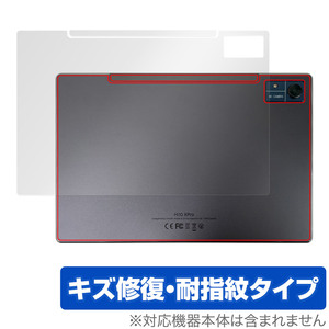 CHUWI Hi10 Xpro 背面 保護 フィルム OverLay Magic ツーウェイ タブレット 本体保護フィルム 傷修復 指紋防止 コーティング