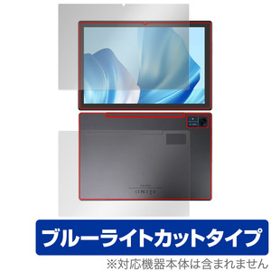 CHUWI Hi10 Xpro 表面 背面 フィルム OverLay Eye Protector ツーウェイ タブレット 表面・背面セット 目に優しい ブルーライトカット