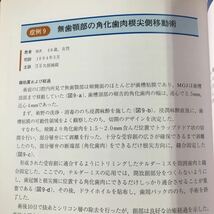 S6f-027 新MGS法 著者 児玉利郎 平成10年8月10日 第1版第1刷発行 医学情報社 歯科 医学 医療 手術 論文 写真 歯医者 歯周炎 テルダーミス_画像7