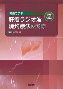 【中古】 動画で学ぶ肝癌ラジオ波焼灼療法の実際 DVD+BOOK