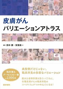 【中古】 皮膚がんバリエーションアトラス