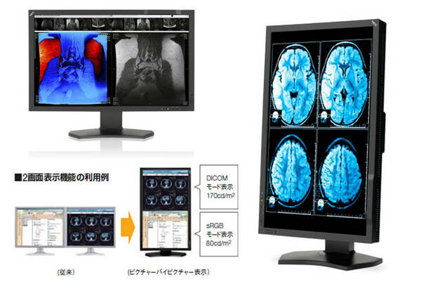 3545　希少品！医用画像表示用液晶　NEC　MD242C2　24.1型　WUXGA　HDMI/DisplayPort　IPSパネル　LED　縦横表示　ディスプレイ