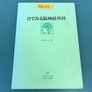 B16-077 目でみる脳神経外科 増改訂第二版 太田富雄 監修