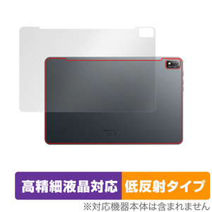 Blackview Tab 16 背面 保護 フィルム OverLay Plus Lite ブラックビュー タブレット 本体保護フィルム さらさら手触り低反射素材