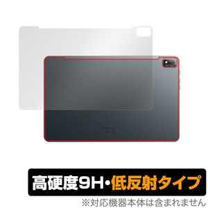 Blackview Tab 16 背面 保護 フィルム OverLay 9H Plus ブラックビュー タブレット 9H高硬度 さらさら手触り反射防止