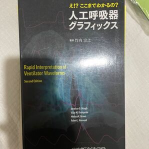 え!? ここまでわかるの? 人工呼吸器グラフィックス