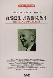 【中古】 自然療法で「乾癬」を治す (エドガー・ケイシー文庫)