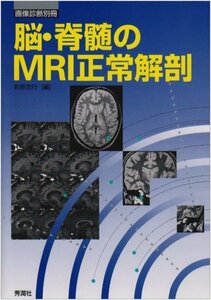 【中古】 脳・脊髄のMRI正常解剖 (画像診断別冊)