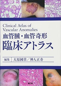 【中古】 血管腫・血管奇形 臨床アトラス