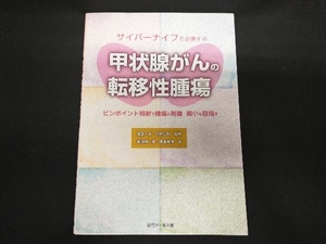 サイバーナイフで治療する甲状腺がんの転移性腫瘍 渡邉一夫