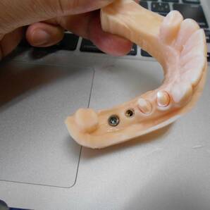 歯科 歯科技工 3Dプリントにインプラントレプリカを戻すための製作手順書 Meshmixer+Labo Scannerの画像1