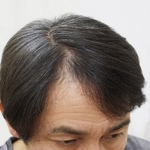 【即納】ボタニ・ヘアグロー PLUS ブラック 150g 黒 コジット 白髪かくし ミクロ 粉末 男女兼用 洗い流せる 日本製_画像4