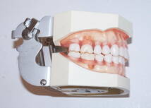 NISSIN 歯周病 歯科 模型 歯周外科 顎模型 歯科衛生士 ニッシン スケーリング スケーラー SRP 歯石 マネキン 超音波 ペリオ 舌 1_画像3