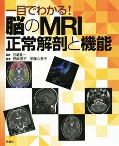 一目でわかる！脳のＭＲＩ正常解剖と機能／石藏礼一,野崎園子,安藤久美子