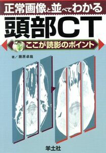 正常画像と並べてわかる　頭部ＣＴ ここが読影のポイント／藤原卓哉(著者)