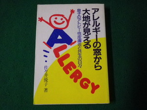 ■アレルギーの窓から大地が見える 息子のアトピー性皮膚炎と共生の日々 佐々井優子 芽ばえ社 1988年2刷■FAUB2023081412■