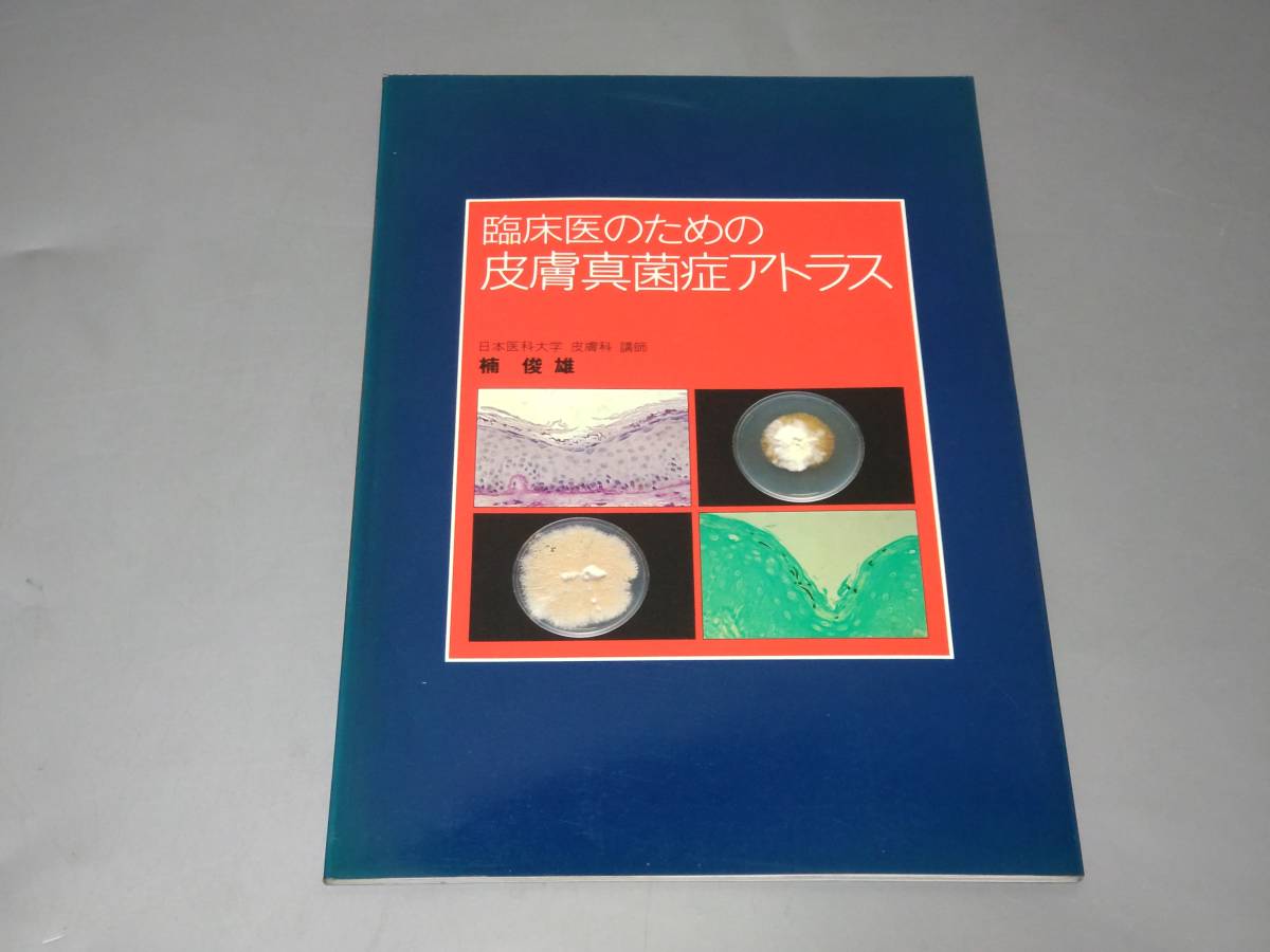 2023年最新】Yahoo!オークション -#真菌症の中古品・新品・未使用品一覧