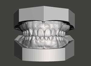 歯科　歯科技工　基底部ベースモデルを使用した中空モデル作成方法　mp4 meshmixer
