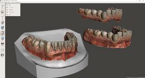 歯科　歯科技工　iosデータを使用したカラーデジタルセットアップモデル 製作手順書　pdf ベースとラインメッシュ　矯正　