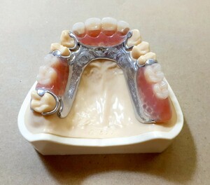  postage included on . metal floor tooth . sample sample artificial tooth tooth ... self cost materials 