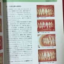 M6g-309 歯科の総合情報誌 学術経営社会 Dental Diamond 本当はやさしい?むずかしい？ 歯周治療 1991年12月1日発行 エントロピーと‥_画像6