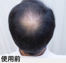 薄毛増毛ヘアーパウダー噴霧式ボトルタイプ：ダークブラウン：日本製プロ用ふりかけ禿げつむじ白髪隠しボリュームアップファンデーション1_画像6