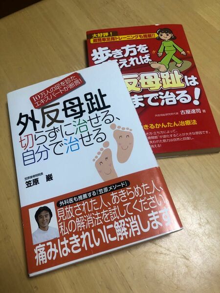 外反母趾切らずに治せる、自分で治せる 歩き方を変えれば外反母趾はここまで治る!