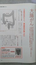 特2 52454 / 北海道の病院 2013 2013年2月20日発行 進化する「白衣」 手術数上位病院の「名執刀医」に聞く 胃がん 白血病 脳卒中 心臓_画像4