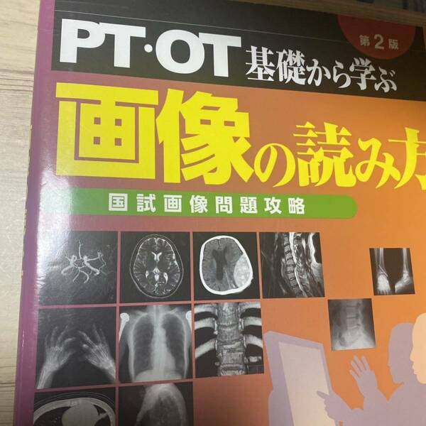 ＰＴ・ＯＴ基礎から学ぶ画像の読み方　国試画像問題攻略 （第２版） 中島雅美／編著　中島喜代彦／編著　大村優慈／編著