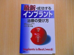 最新・成功するインプラント治療の受け方