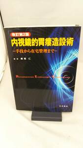 内視鏡的胃瘻造設術 嶋尾仁