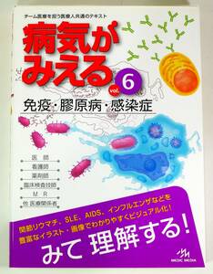 病気がみえる 〈vol.6〉 免疫・膠原病・感染症 (Medical Disease:An Illustrated Reference)