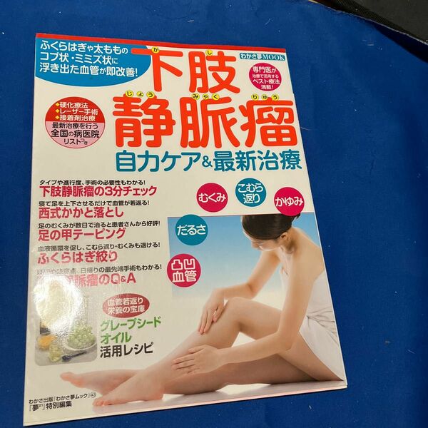 下肢静脈瘤自力ケア&最新治療 ふくらはぎや太もものコブ状ミミズ状に浮き出た血管が即改善! 専門医が治療で活用するベスト療法