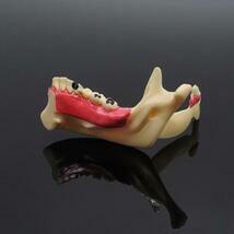 歯科歯内治療モデル歯茎歯科研究ティーチ歯の解剖モデル_画像2