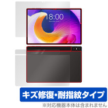 Teclast T45HD 表面 背面 フィルム OverLay Magic for テクラスト T45HD 表面・背面セット 傷修復 耐指紋 指紋防止 コーティング_画像1