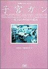 【中古】 子宮ガン―生きるための私の選択 (Oggi BOOKS)