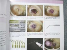 VE96-065 ヒョーロンパブリッシャーズ 日本歯科評論 2017 12月 No.902 Vol.77 10S3C_画像4