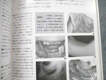 VE21-007 日本医療文化センター 修得できる口腔小手術 1988 18S6C_画像5
