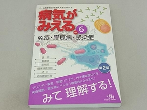 病気がみえる 免疫・膠原病・感染症 第2版(vol.6) 医療情報科学研究所