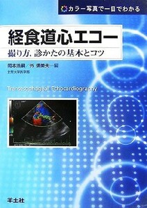 経食道心エコー 撮り方、診かたの基本とコツ　カラー写真で一目でわかる／岡本浩嗣，外須美夫【編】